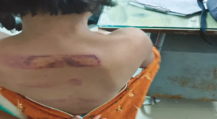 আট বছরের শিশুকে শিক্ষকের নির্মম মারধর, ‘বদলা’ দেখছেন গ্রামবাসীরা