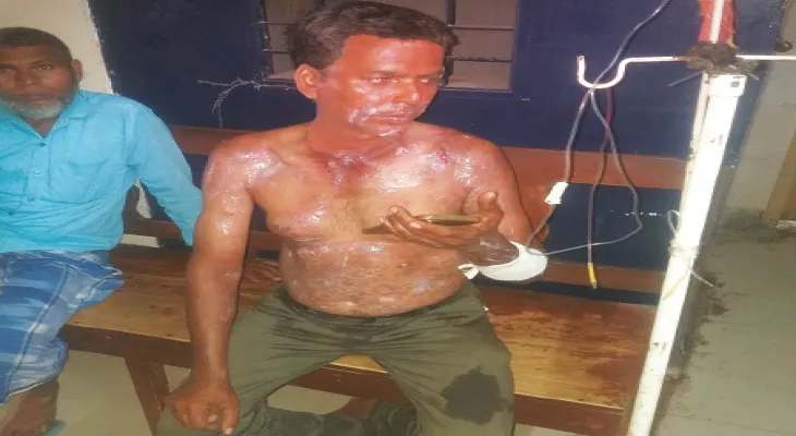আন্ডারপাসের কাজ করতে গিয়ে সিলিন্ডার ফেটে বিপত্তি, গুরুতর জখম সাত