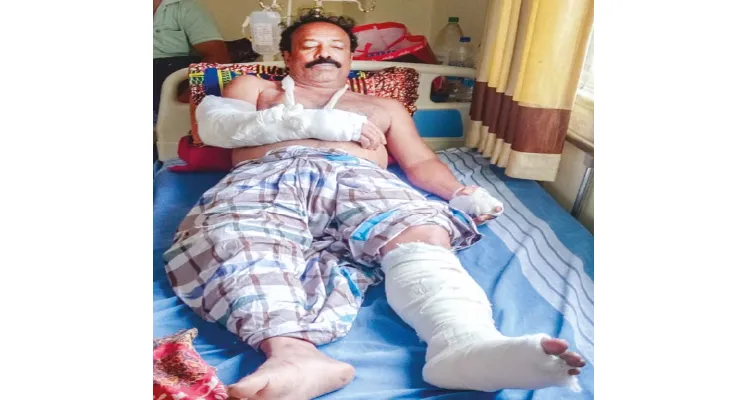 বোলপুরে প্রাক্তন কর্মাধ্যক্ষকে মারধরের অভিযোগ কাজল অনুগামীদের বিরুদ্ধে