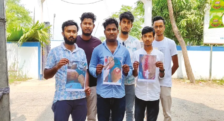 চাঁচলে বাইক রাখার প্রতিবাদ করায় ছুরির আঘাত, আশঙ্কাজনক দুই ভাই