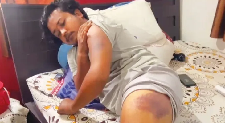 পুলিসের গাড়ির চালকের দাদাগিরি, থানায় তুলে নিয়ে গিয়ে যুবককে মার