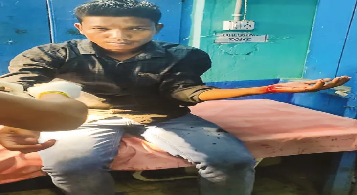 ময়নাগুড়িতে স্ত্রীর প্রেমিককে ধারালো অস্ত্রের কোপ