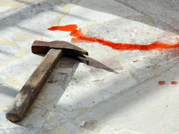 চপারের কোপ, গুরুতর জখম ব্যক্তি