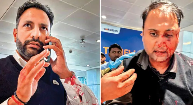 বচসার জের, ঘুসি মেরে যাত্রীর নাক ফাটালেন পাইলট
