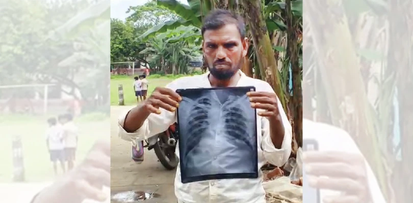 টাকার পাহাড়ে প্রাক্তন ‘বাবু’ টুলু, বুকে পাথরের ধুলো নিয়ে মৃত্যুর অপেক্ষায় শ্রমিকরা