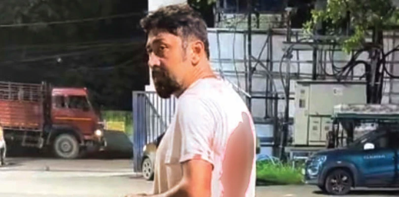 বাড়ি ফেরার পথে ব্যবসায়ীকে চপারের কোপ, আড়াই লক্ষ ছিনতাই দুষ্কৃতীদের