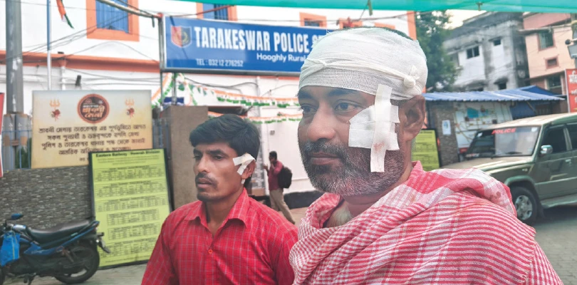 তারকেশ্বরে বিজেপির দুই গোষ্ঠীর দ্বন্দ্বে মারধর, মাথা ফাটল কর্মীর