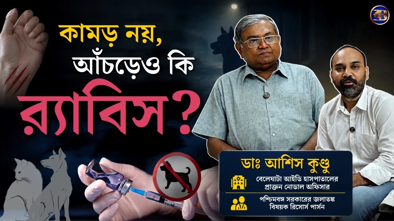 কুকুরে কামড়েছে? প্রথমেই কী করবেন | র‍্যাবিস ভ্যাকসিন কখন জরুরি? জানালেন Dr Ashish Kundu