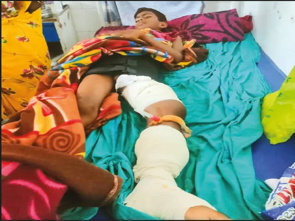 উত্তরবঙ্গ মেডিক্যালের পরিষেবায় সুস্থ হয়ে উঠছে মারাত্মক জখম কিশোর