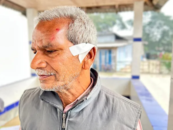 ময়নাগুড়িতে কাকাকে মেরে কান ফাটিয়ে দেওয়ার অভিযোগ ভাইপোর বিরুদ্ধে, চাঞ্চল্য